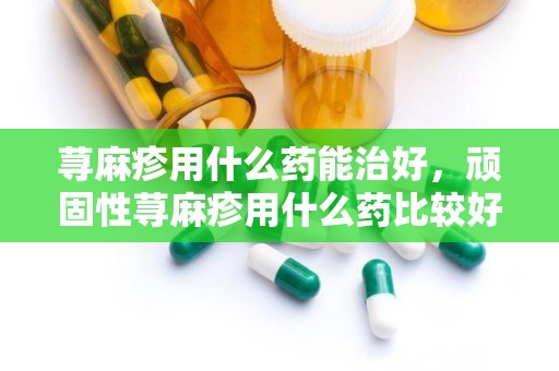 荨麻疹用什么药能治好，顽固性荨麻疹用什么药比较好