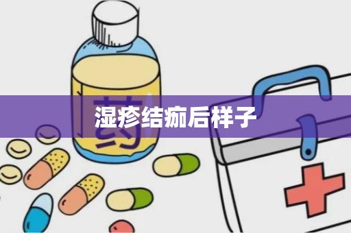 湿疹结痂后样子