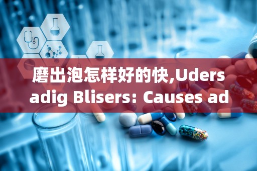 磨出泡怎样好的快,Udersadig Blisers: Causes ad Types