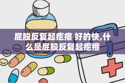 屁股反复起疙瘩 好的快,什么是屁股反复起疙瘩