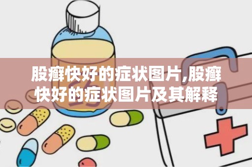 股癣快好的症状图片,股癣快好的症状图片及其解释