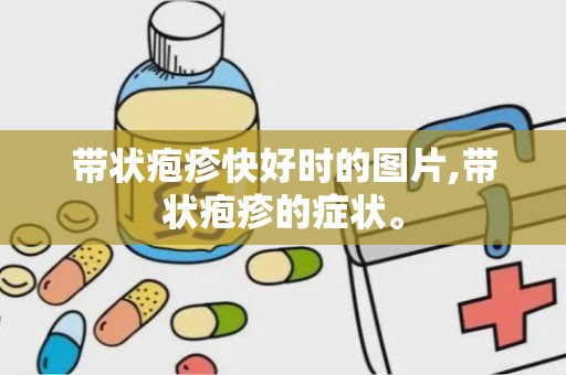 带状疱疹快好时的图片,带状疱疹的症状。