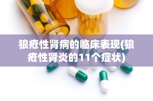 狼疮性肾病的临床表现(狼疮性肾炎的11个症状)