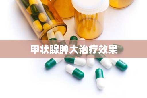 甲状腺肿大治疗效果