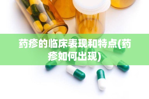 药疹的临床表现和特点(药疹如何出现)