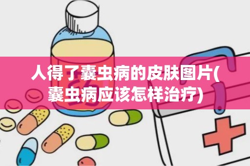 人得了囊虫病的皮肤图片(囊虫病应该怎样治疗)